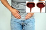 Bladder Cancer reasons, Bladder Cancer articles, why is bladder cancer common in men, Cigarette