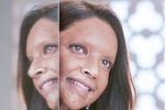 Deepika Padukone, Chhapaak, first look of deepika padukone as acid attack survivor, Padmaavat