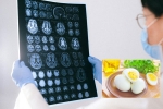 Eggs and Alzheimer’s news, Eggs and Alzheimer’s news, eggs may help prevent alzheimer s study, Line