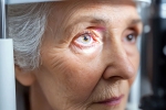 Glaucoma, Glaucoma symptoms, all about the eye disease glaucoma, Tse
