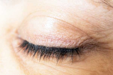 All about Eyelash Dandruff