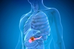 Pancreatic Cancer doctors, Pancreatic Cancer, how to protect yourself from pancreatic cancer, Cancer