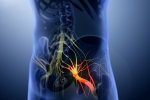 disorder care, disorder care, help yourself on sciatica, Natural remedies