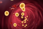 Lower Cholesterol, Lower Cholesterol, tips to lower cholesterol when statins don t work, Anjali